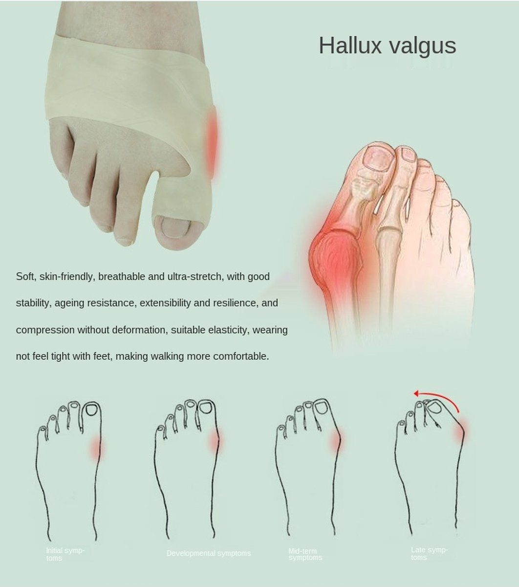 Hallux Valgus Silicone Toe Protectors | Toe Separators | Toe Corrector | Bunion | Bunion | Callus | Toe Straightening | 1 Pair | Beige