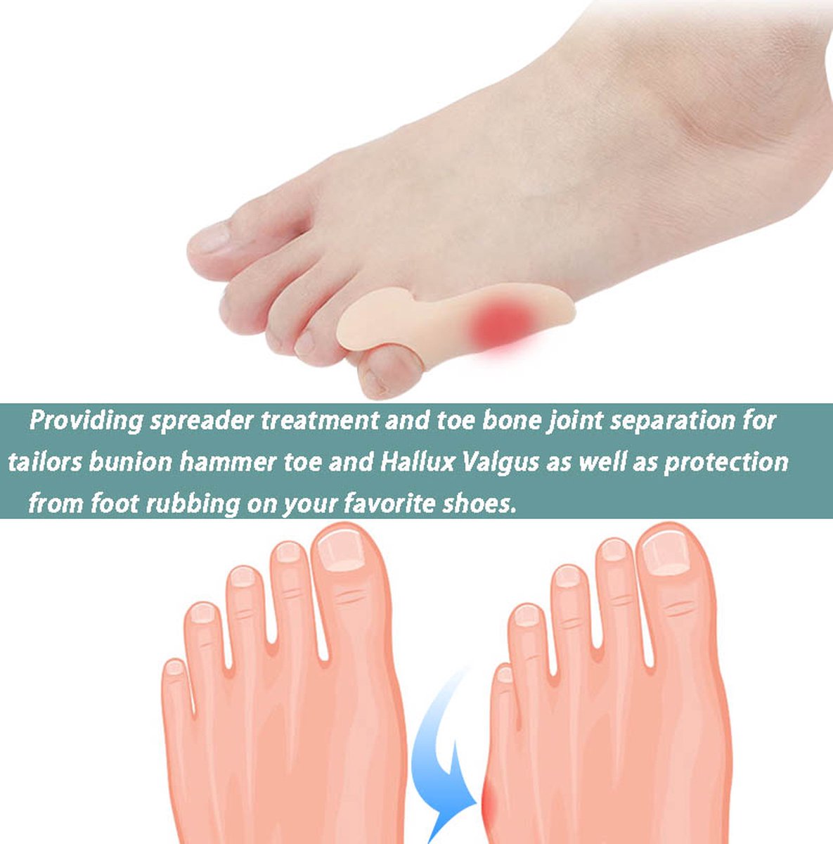 Silicone Toe Corrector Little Toe | Toe Spreader | Little Toe Protector | 1 Pair | Beige