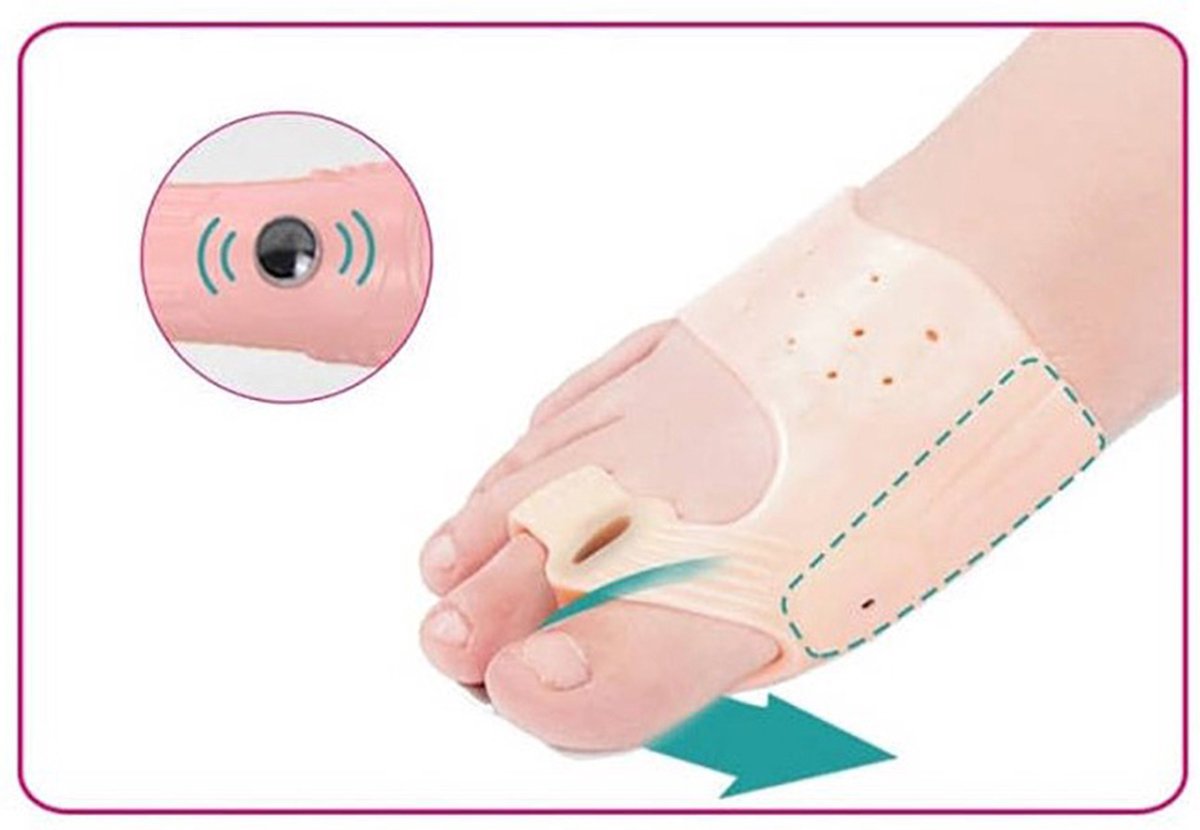 Toe spreader - Bunion toe corrector | bunion - Straighten toe - Bunion