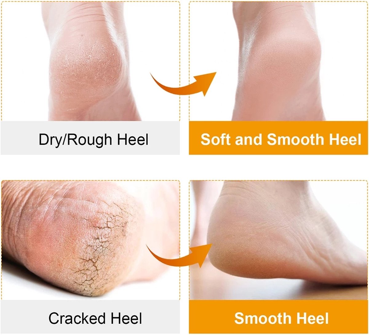 Silicone gel socks | Heel protectors | Heel insoles | Heel cushions | Heel socks | 1 pair | White