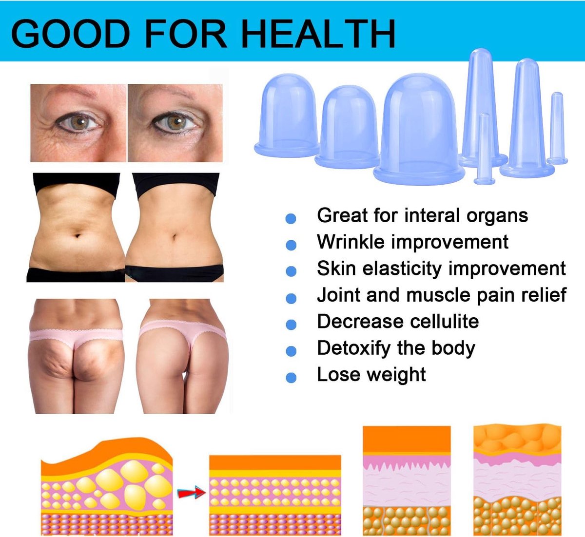 Cellulite Cups - Cupping For Cellulite - Premium Quality Cupping Set (7-Piece) - Cupping Cups - Full Body - Cupping Cups Massage - For Face, Arms And Legs - Blue - Vacuum Silicone Cupping Set - Anti-Orange Peel - Anti-Cellulite Massage