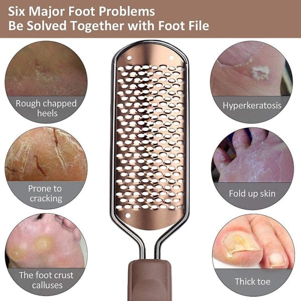 Professional Stainless Steel Pedicure Foot File Hard Skin Remover Large Foot Rasp Colossal Wet and Dry Feet Scrub