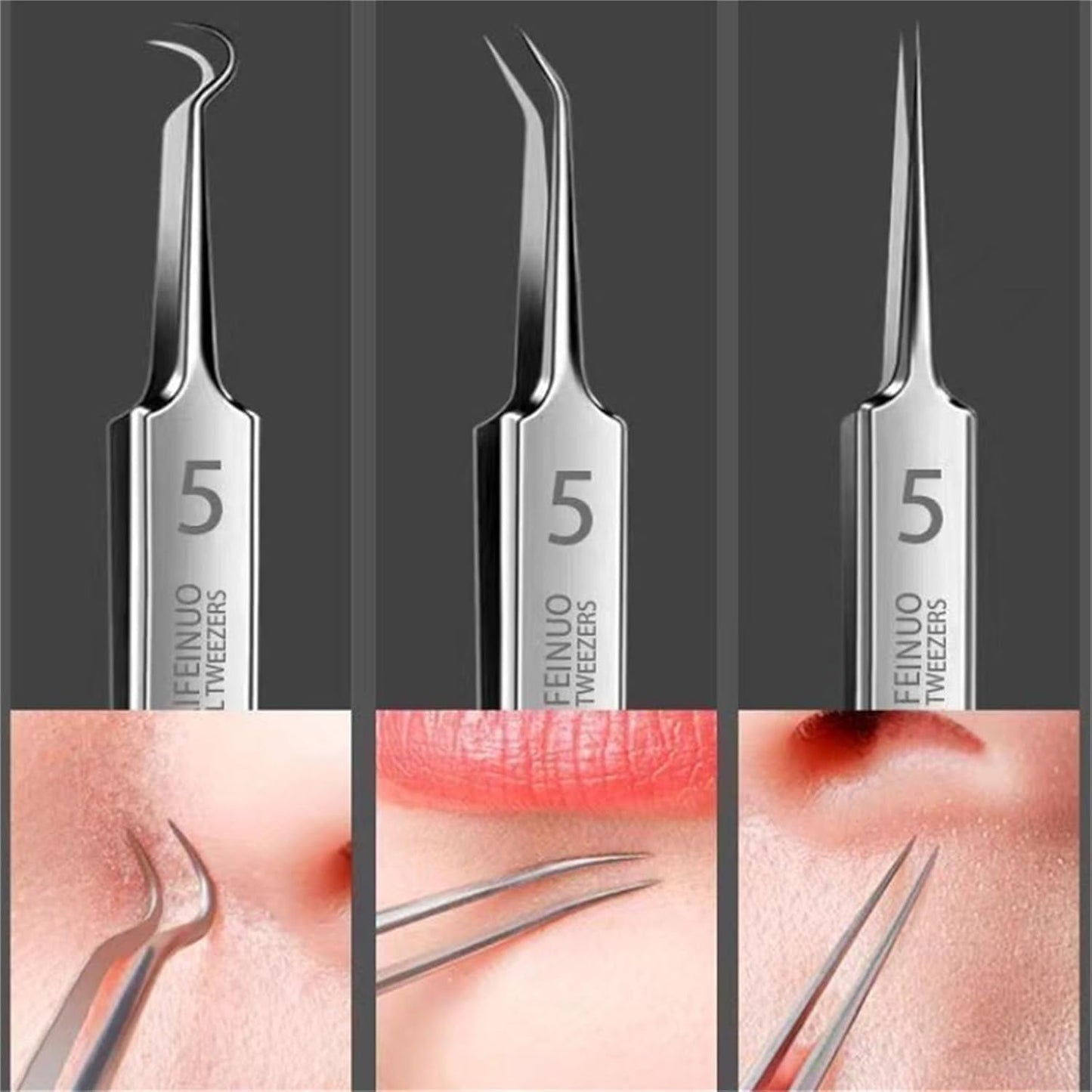 BYXAS Pimple Popper Tool Kit, 8 PCS Professional Stainless Steel Blackhead Remover Comedone Extractor Tools for Removing Zit on Face - Acne Removal Kit with Metal Case (Silver) 11PCS