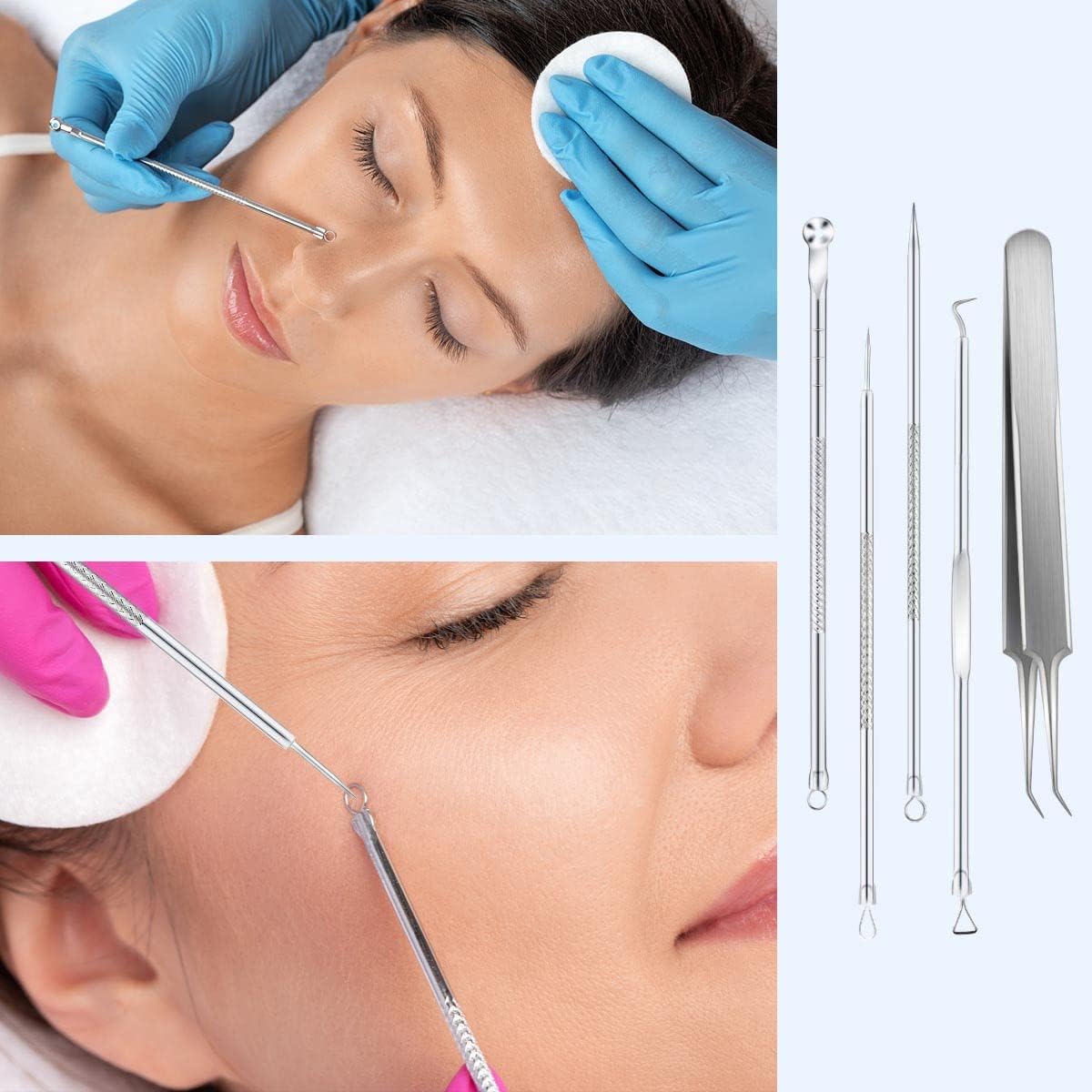 Blackhead Remover Tool Pimple Popper Kit 5 Pack Extractor Tools with Case Comedone Zit Acne Blemish Whitehead Removal Professional Stainless Steel for Face Nose