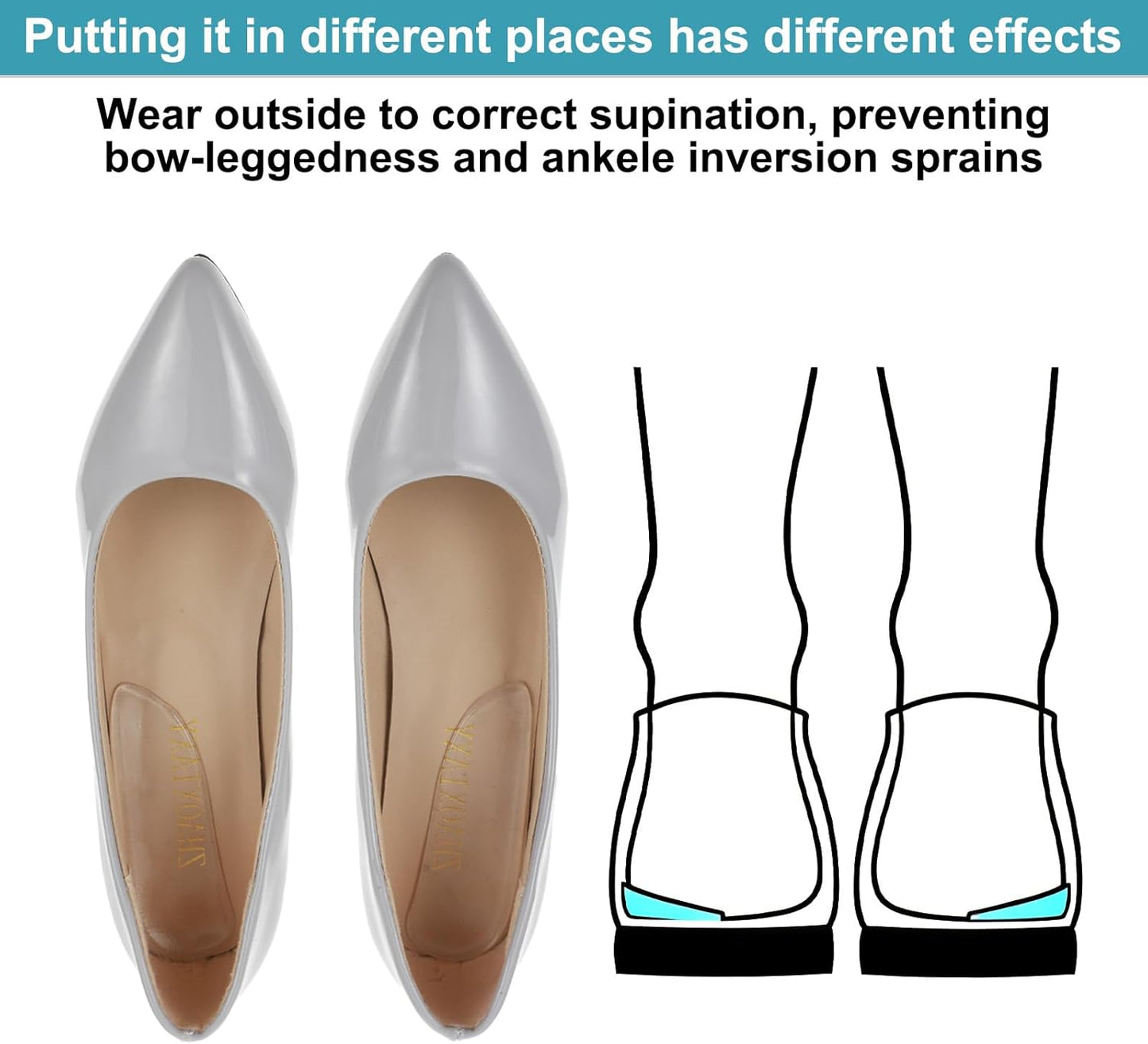 5 Pairs Medial & Lateral Heel Wedge Silicone Insoles, Corrective Adhesive Shoe Inserts for Foot Alignment Knock Knee Pain Bow Legs Osteoarthritis for Men Women