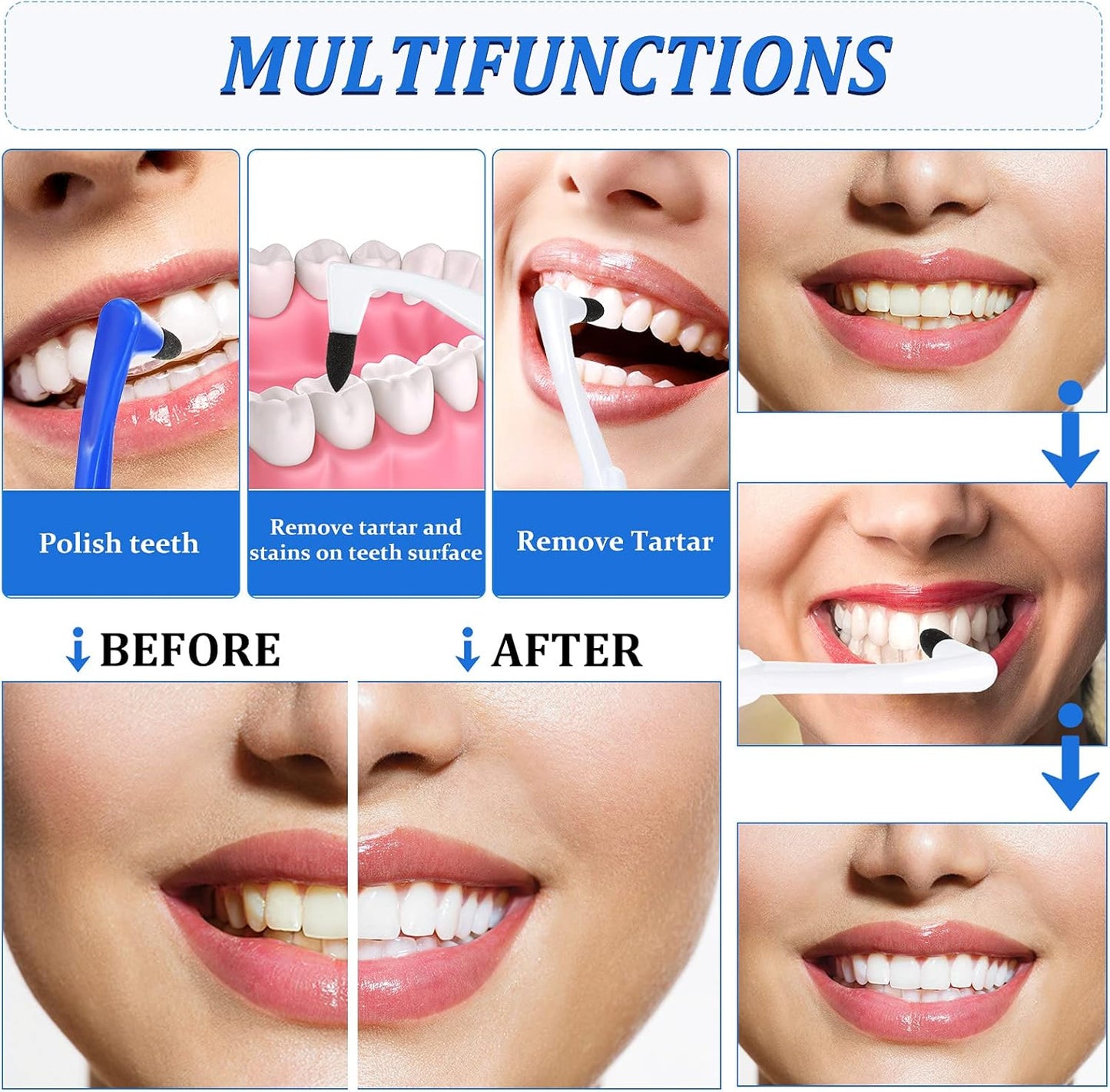 8 Pieces Tooth Stain Eraser Tooth Stain Removers Tartar Remover Plaque Remover for Teeth Dental Polisher Cleaning Kit for Whitening Polishing