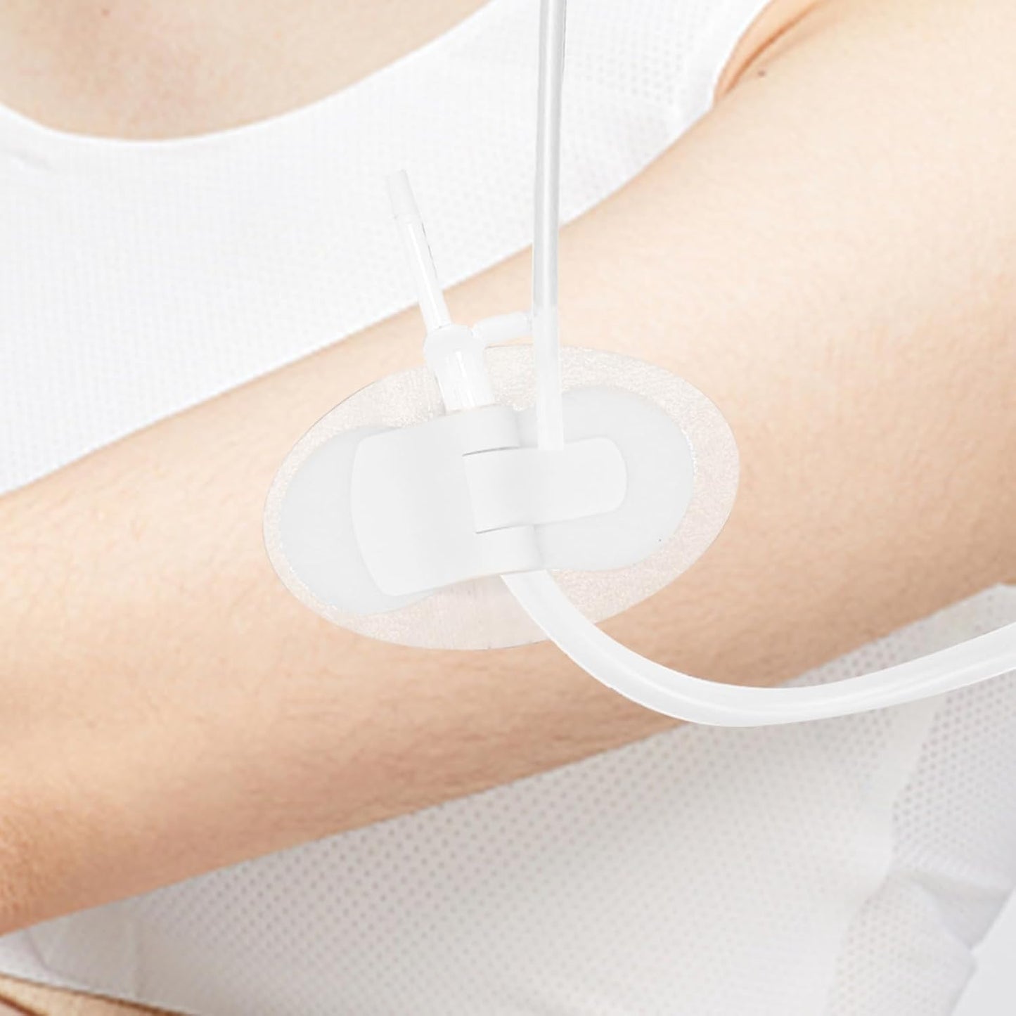 10Pcs Foley Catheter Stabilization Device, Urinary Catheter Leg Bag Holder, Adhesive Catheter Urinary Leg Bag Legband Holder, Urinary Catheter Hook and Loop Fixing Device Sticker Catheter Supplies