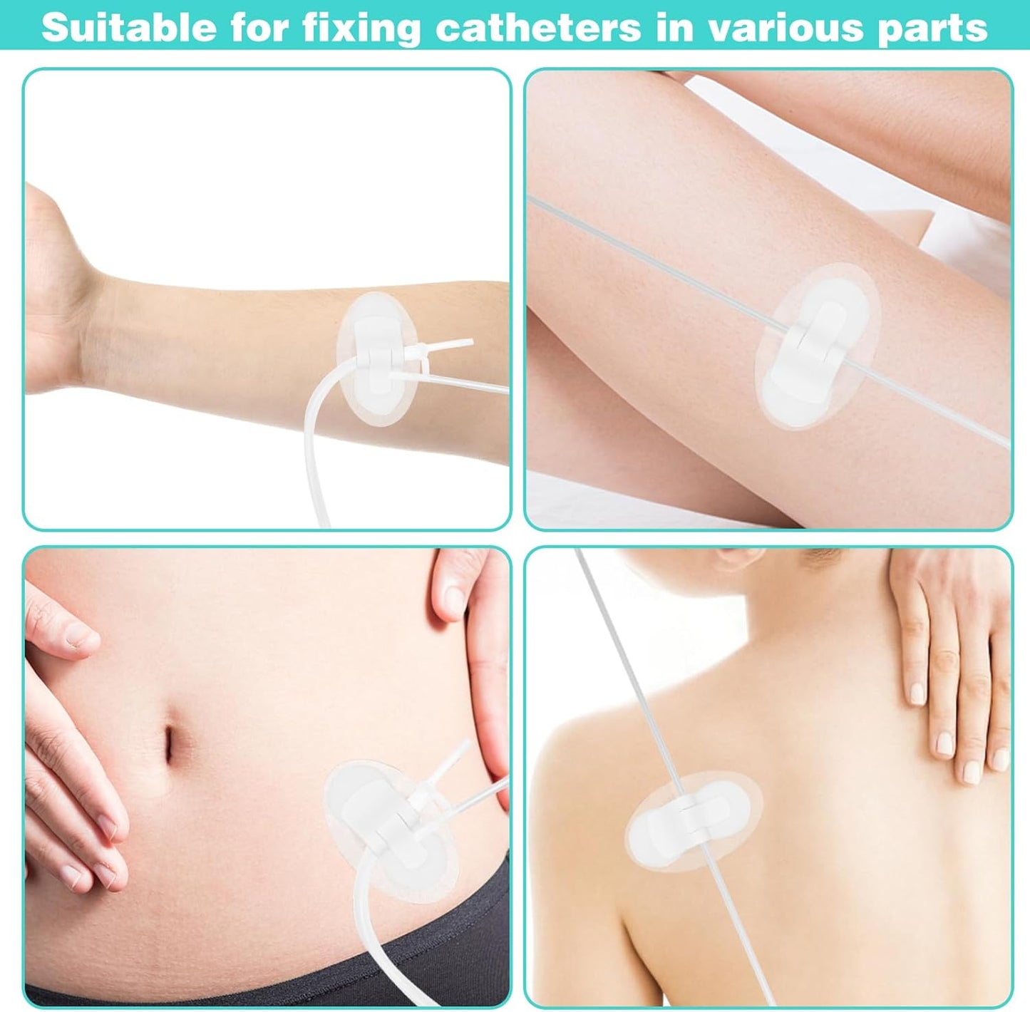 10Pcs Foley Catheter Stabilization Device, Urinary Catheter Leg Bag Holder, Adhesive Catheter Urinary Leg Bag Legband Holder, Urinary Catheter Hook and Loop Fixing Device Sticker Catheter Supplies