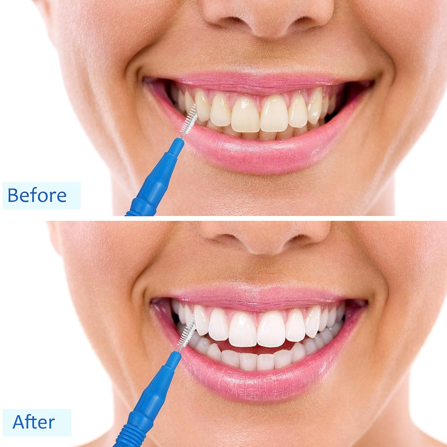 100 Pcs Braces Dental Brush Flosser for Cleaner Interdental Brush Toothpick Tooth Flossing Head Oral Dental Toothpick Cleaners Cleaning Tool(Red and Blue)