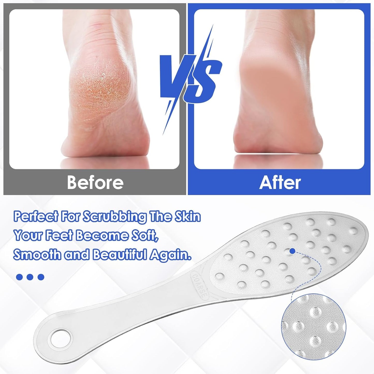 2 Pcs Foot Scraper Pedicure Metal Foot File Callus Remover for Feet Double Sided Foot Exfoliator Tool Set Foot Scrubber Professional Foot Rasp Scrubber for Wet Dry Skin Heel(Silver)