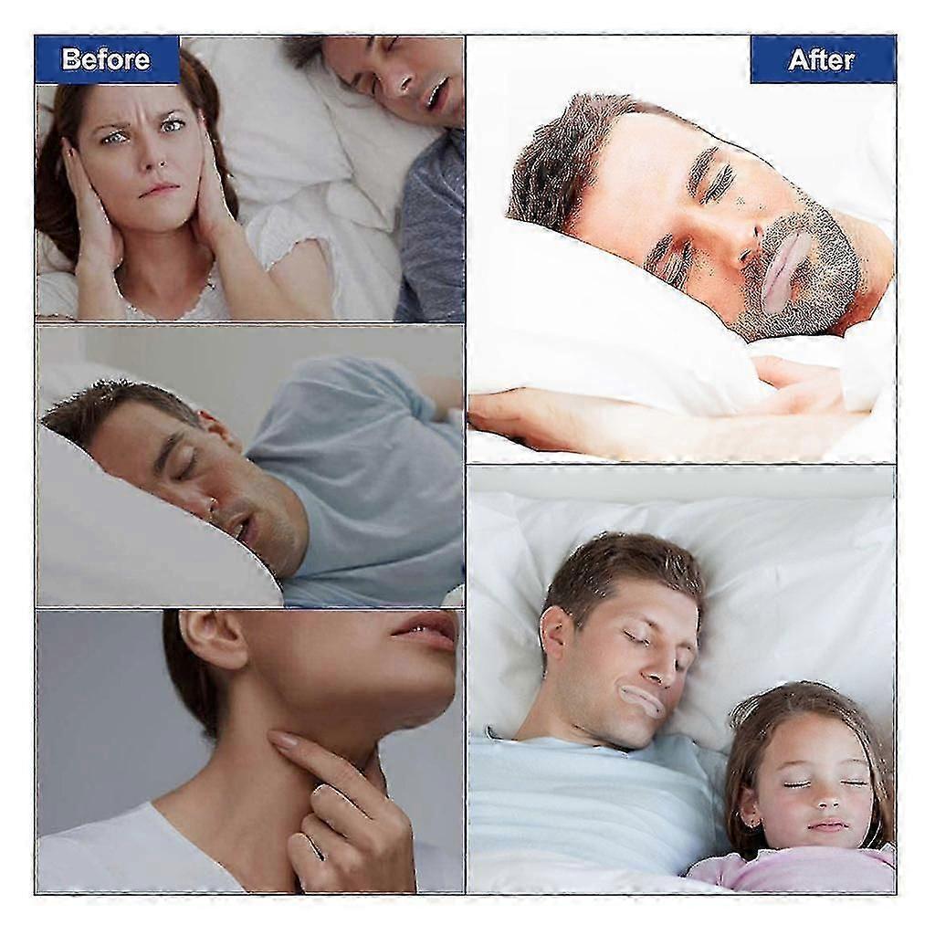 Sleep Strips Mouth Tape For Better Breathing Relief