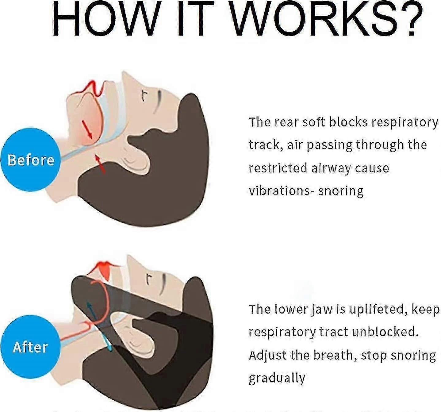 Anti Snoring Chin Strap, Upgrade Stop Snore Chin Strap, Snoring Solution Snore Stopper, Professional Effective Anti Snore Devices Stop Snoring Sleep