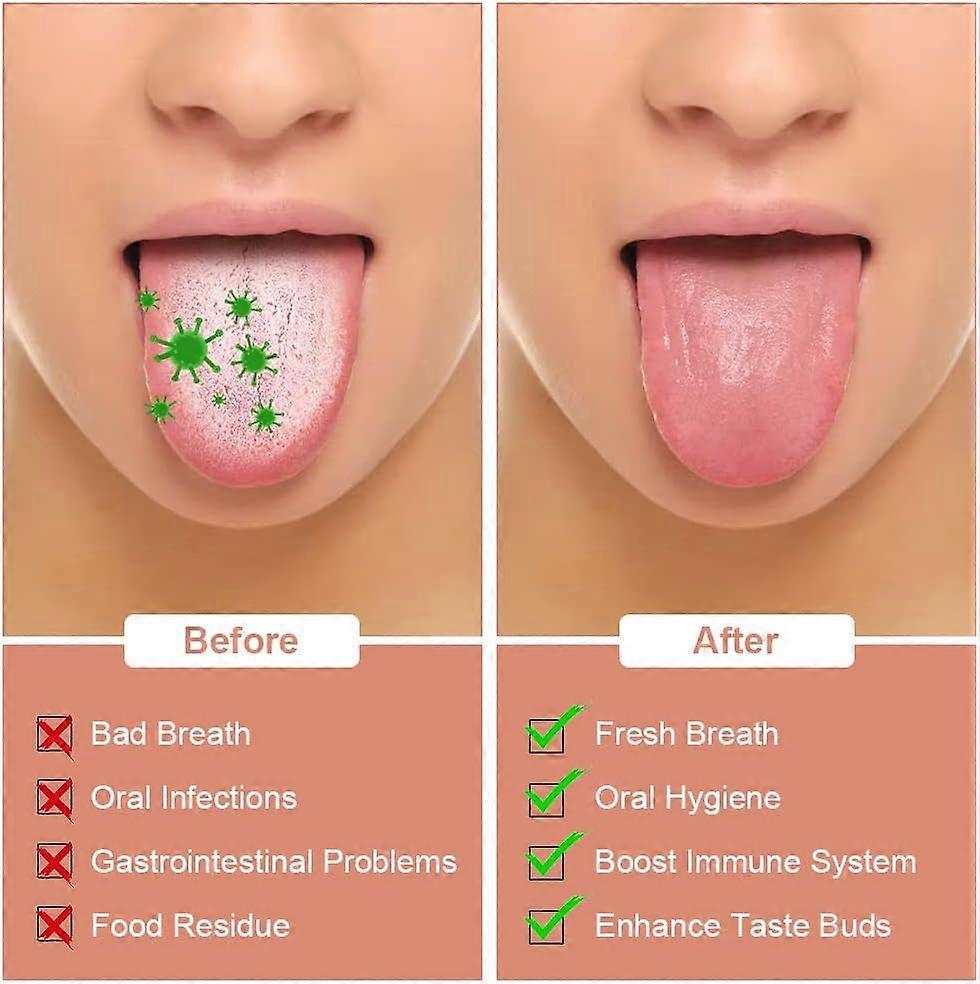 2PCS Stainless Steel Tongue Scrapers, Tongue Cleaner for Bad Breath - Silver