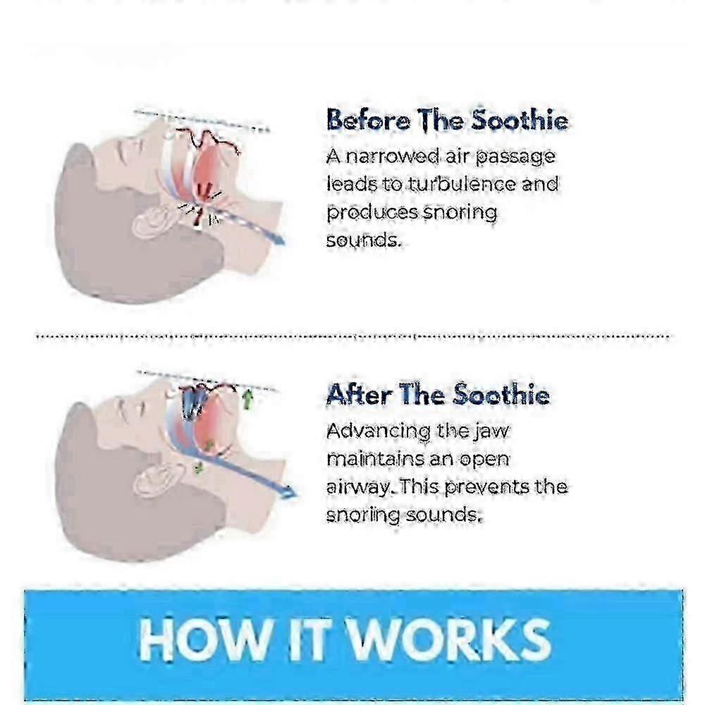 Honex Anti-Snoring Mouthpiece - Quite Night Device, Adjustable Jaw