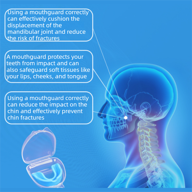4-Pack Black Food Grade Silicone Sports Mouthguard(6x5x1.7CM) With Vented PP Case- Instant Fit Mouth Guardfor High Shock Protection