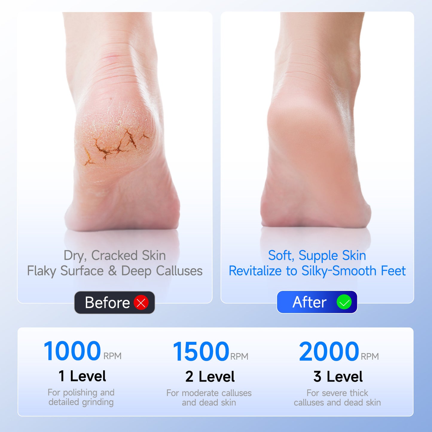 White A1 Compact Electric Foot Dead Skin and Callus Remover - IPX6 Pedicure Tool with 3-Speed Mode & Dual 360°Rotating Stainless Steel Heads