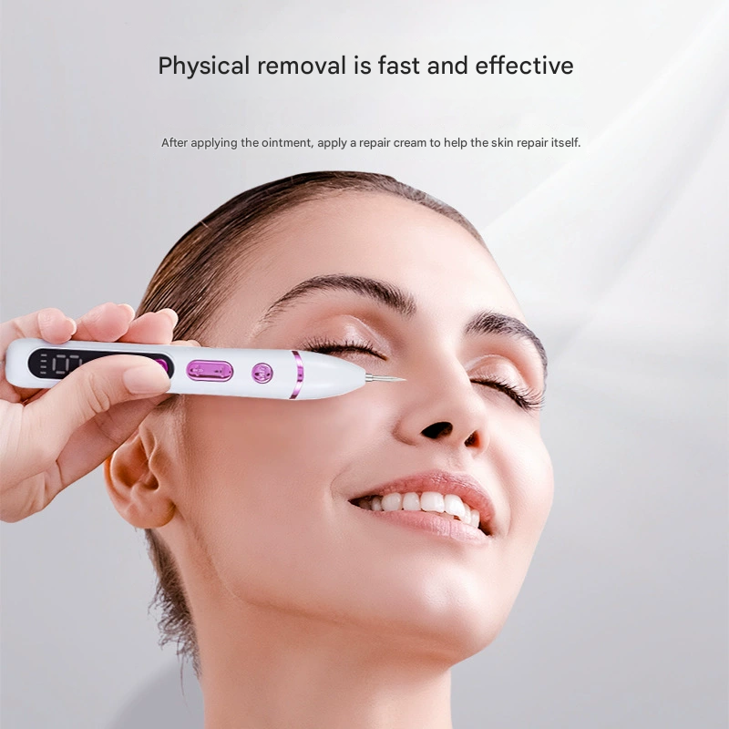 Professional Electric Mole & Dark Spot Remover Pen - Advanced Plasma Ion Technology for Seamless Skin Tag & Freckle Removal (Purple)